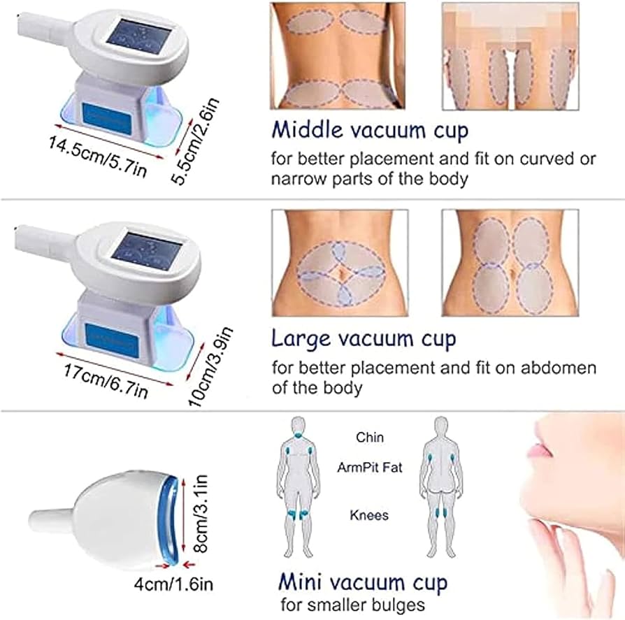 Amazon.co.jp: Cryolipolysis 痩身マシン、3 つのハンドル付き